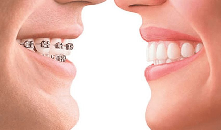 Ortodoncia en Moratalaz, Clínica Dental Balleros